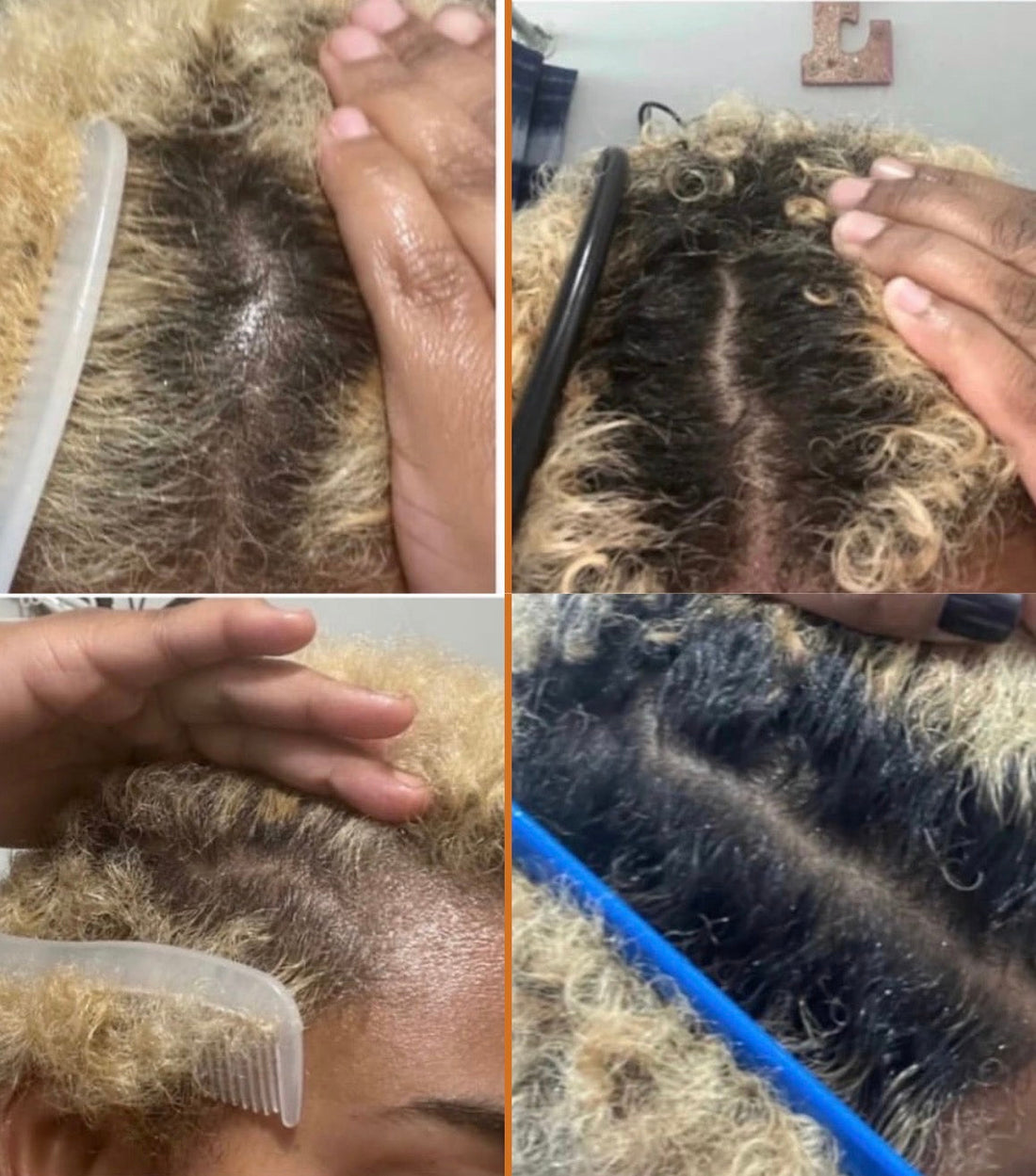 “The Secret to Thicker, Healthier Curls Starts at the Root”