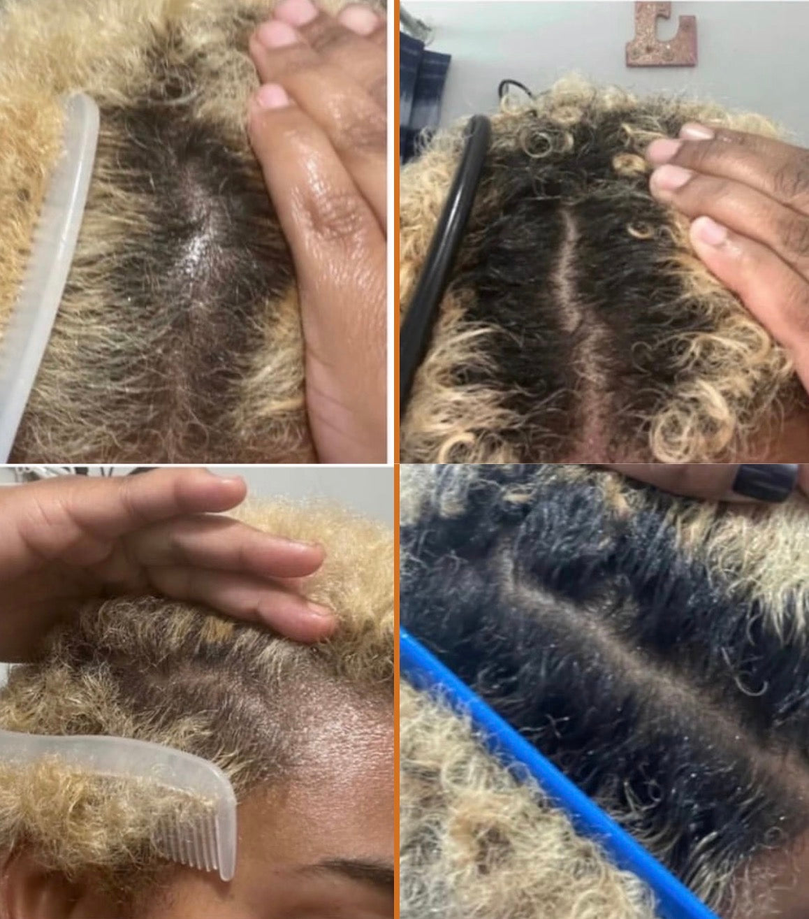 “The Secret to Thicker, Healthier Curls Starts at the Root”
